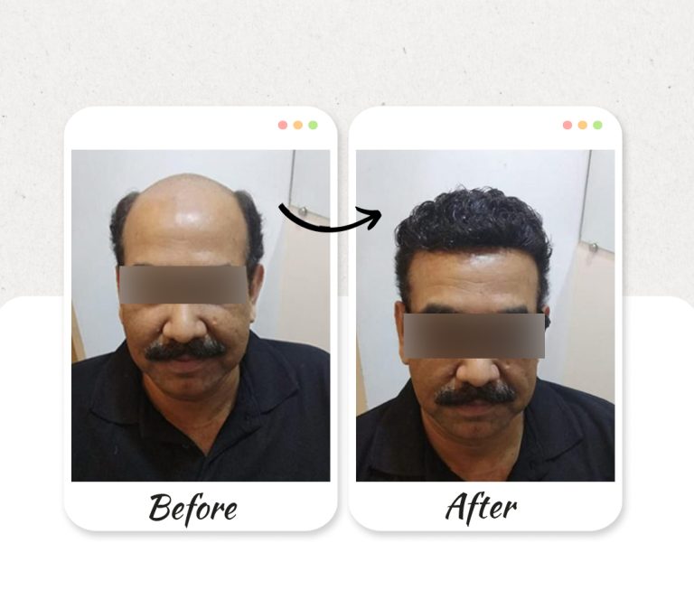 Before-and-After-new-3