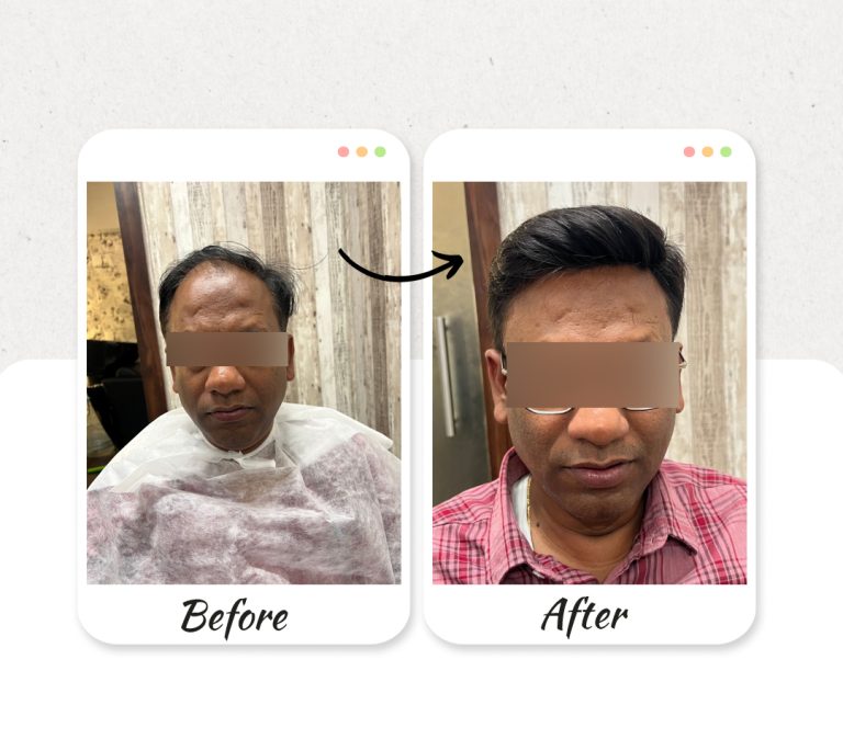 Before-and-After-new-4