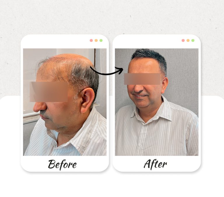 Before-and-After-new1
