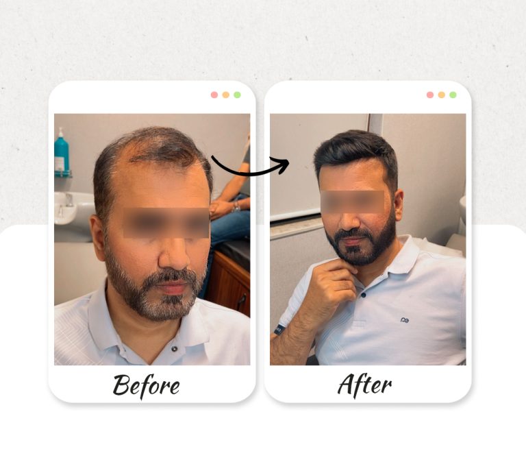 Before-and-After-new2