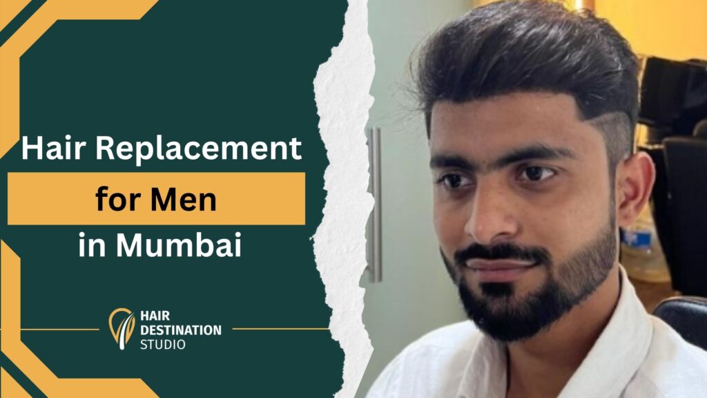 Hair Replacement for Men in Mumbai