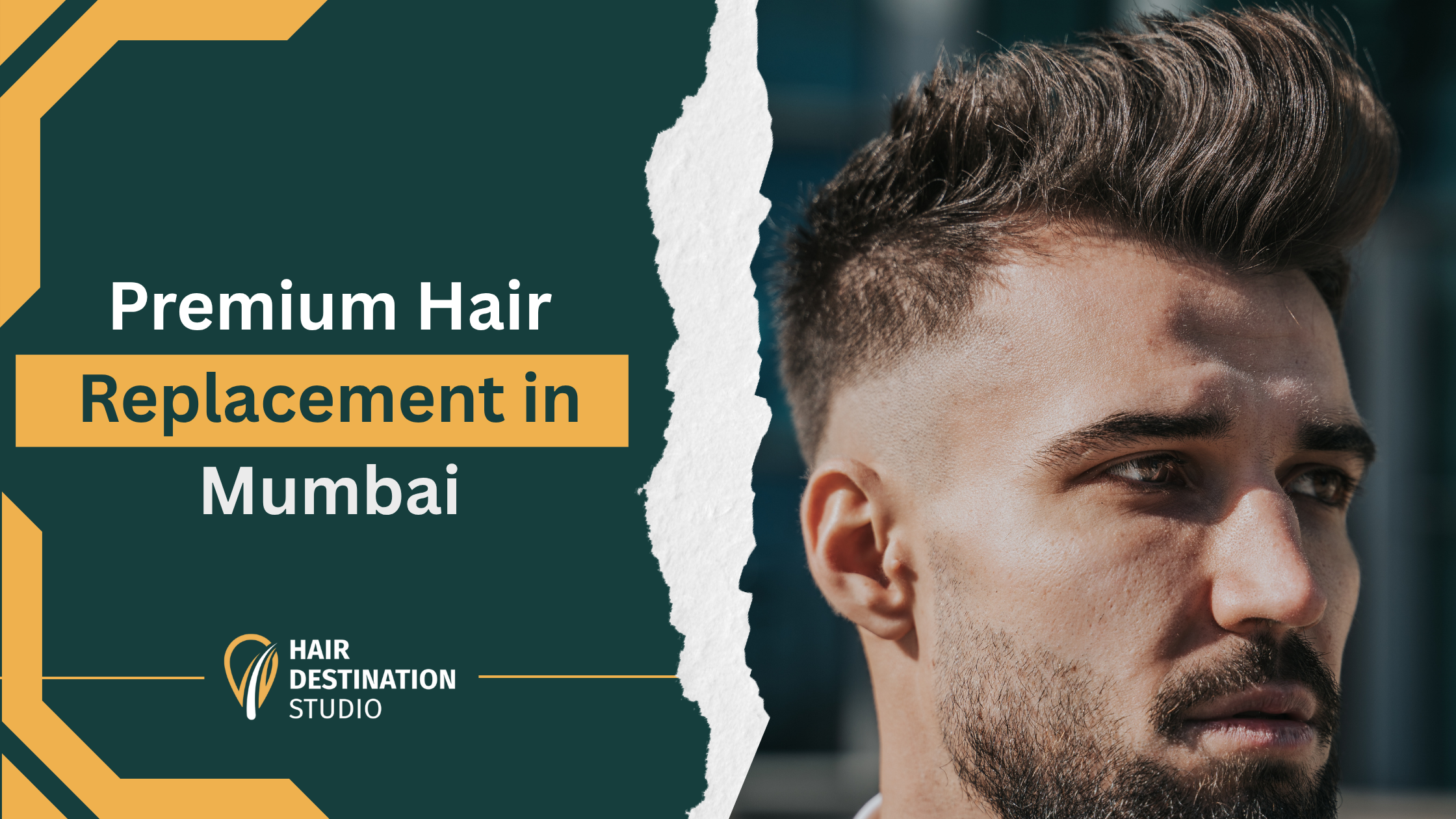 Premium Hair Replacement in Mumbai