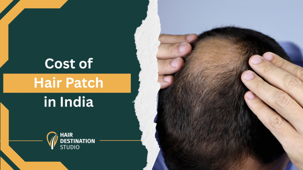 Cost of Hair Patch in India 2025