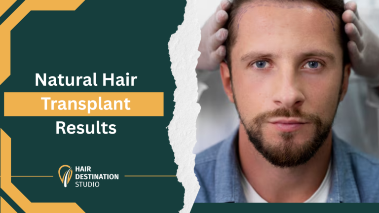 Natural looking non-surgical hair restoration results