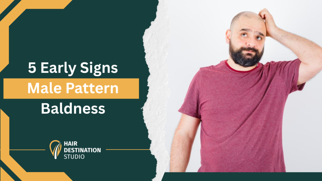 5 Early Signs of Male Pattern Baldness You Should Never Ignore