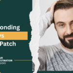 Hair Bonding vs Hair Patch