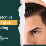 Hair Patch vs Weaving vs Bonding