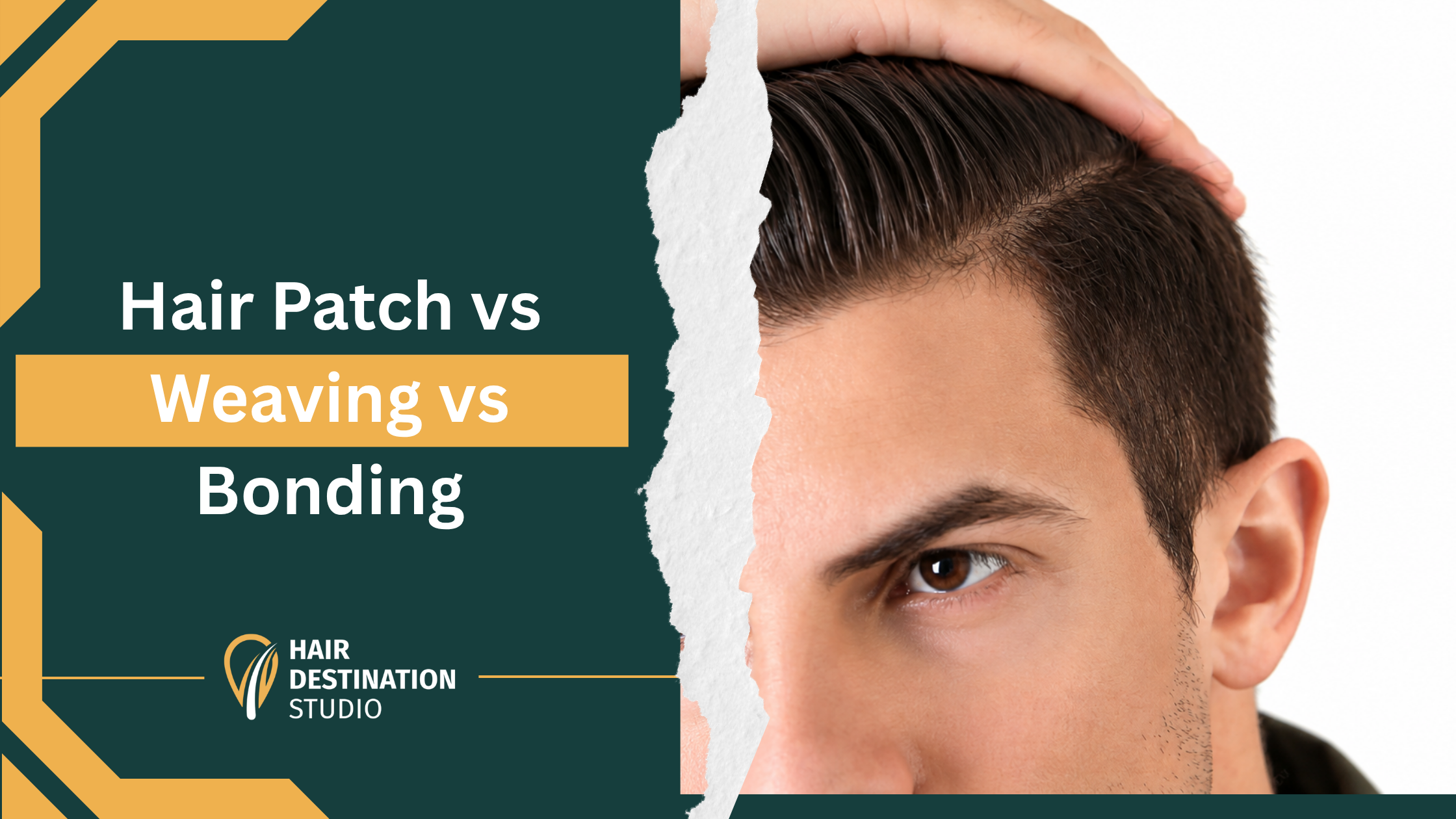 Hair Patch vs Weaving vs Bonding